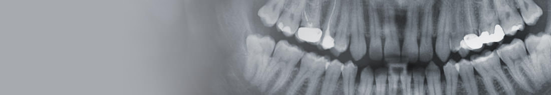 Our oral and maxillofacial surgeries range from general tooth extractions, dento-alveolar surgery, dental implants, oral tumors, facial cancer, TMJ surgery, sleep apnea, and more.